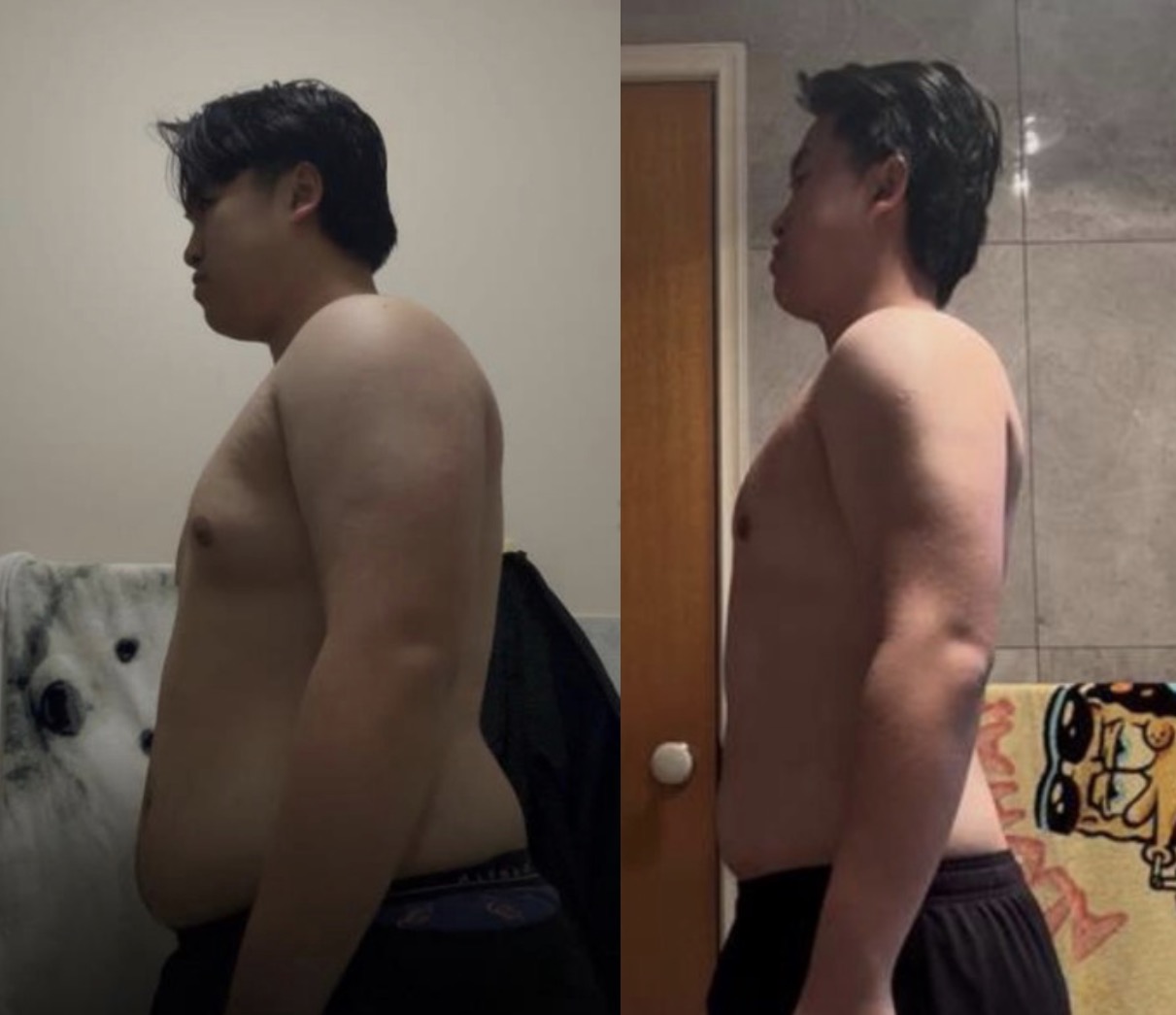 Johnny before / after